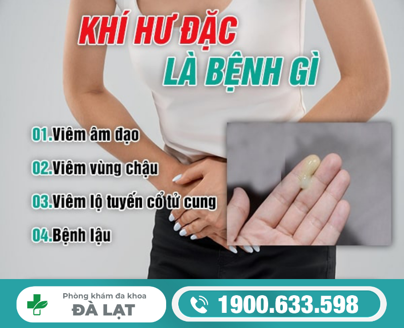 Hình ảnh minh họa